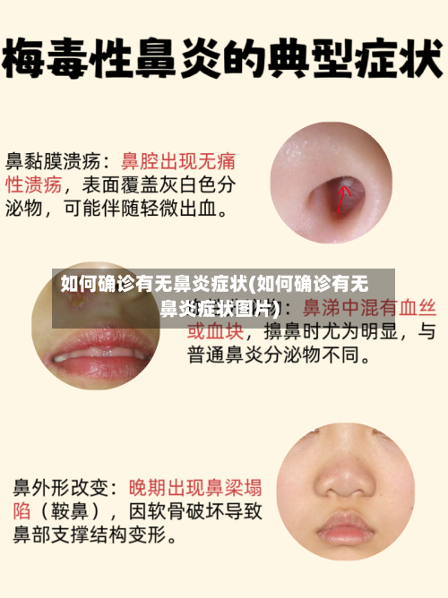 如何确诊有无鼻炎症状(如何确诊有无鼻炎症状图片)