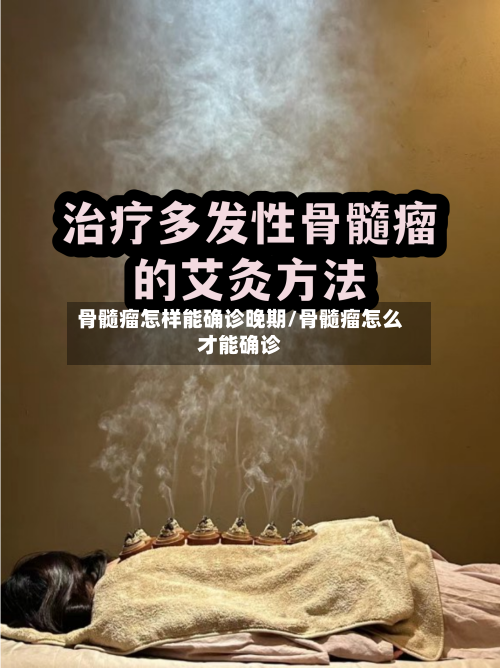 骨髓瘤怎样能确诊晚期/骨髓瘤怎么才能确诊