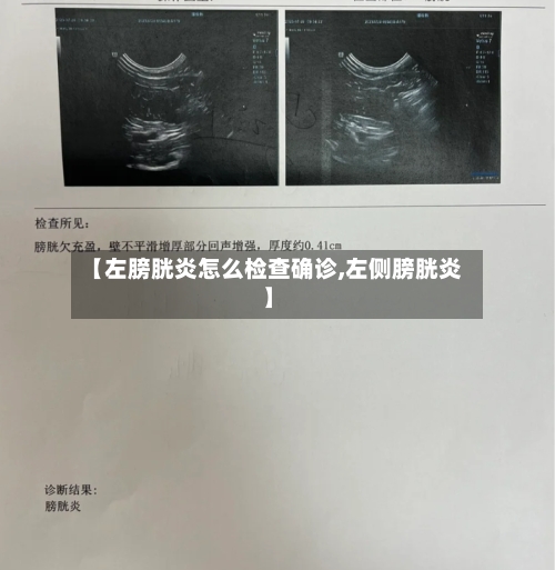 【左膀胱炎怎么检查确诊,左侧膀胱炎】
