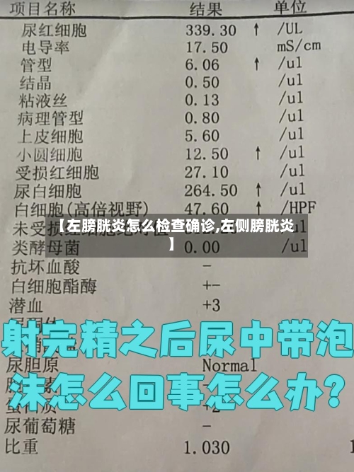 【左膀胱炎怎么检查确诊,左侧膀胱炎】-第3张图片