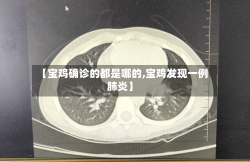 【宝鸡确诊的都是哪的,宝鸡发现一例肺炎】-第2张图片