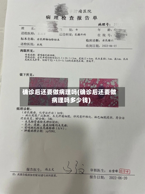 确诊后还要做病理吗(确诊后还要做病理吗多少钱)